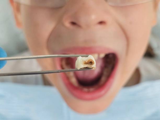 Best Weekend Emergency Dentist in Quincy, CA