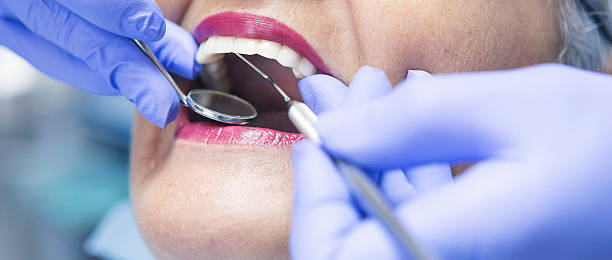 Best Emergency Tooth Extraction in Quincy, CA
